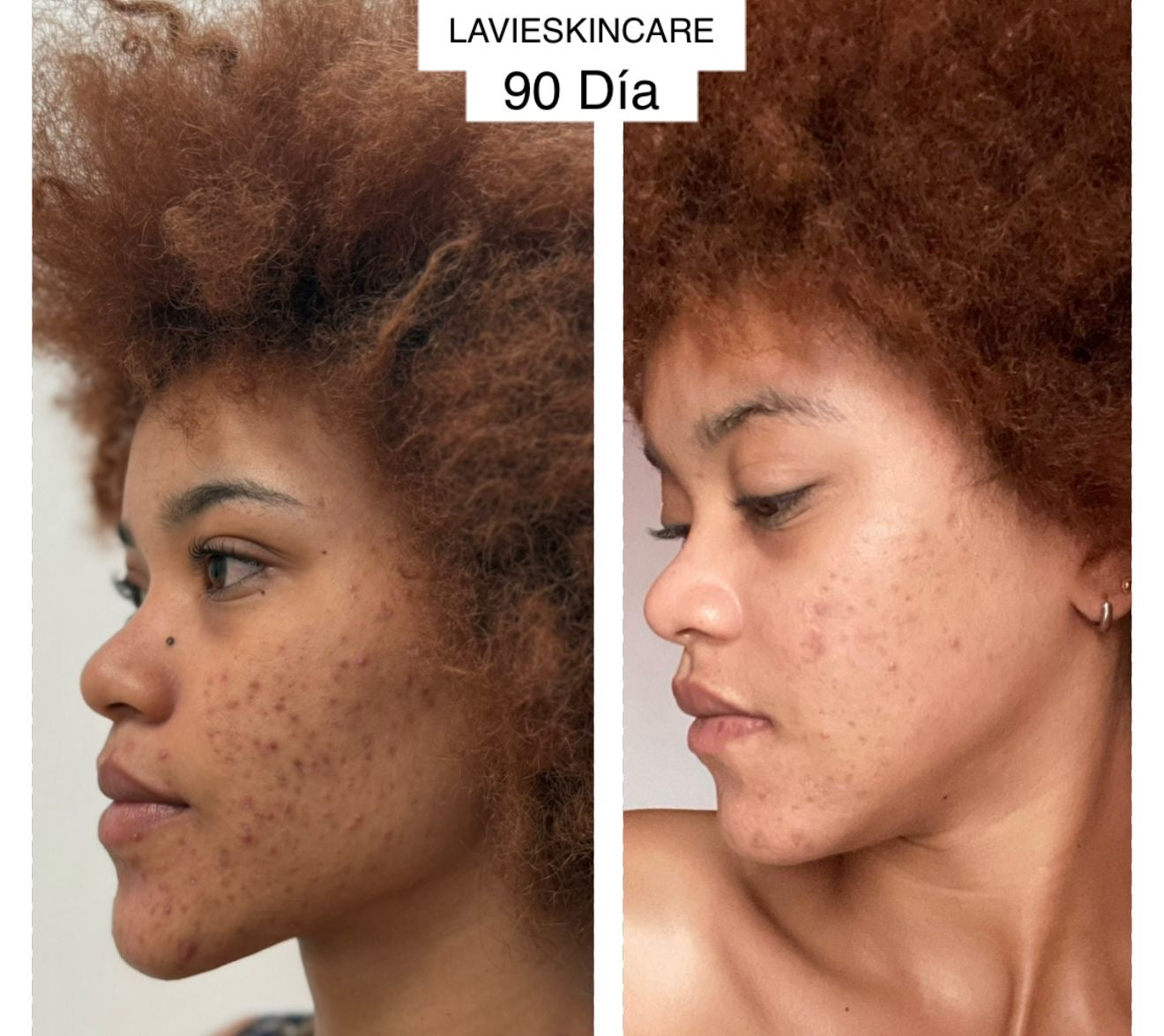 EL ORO PARA TU PIEL🎖️