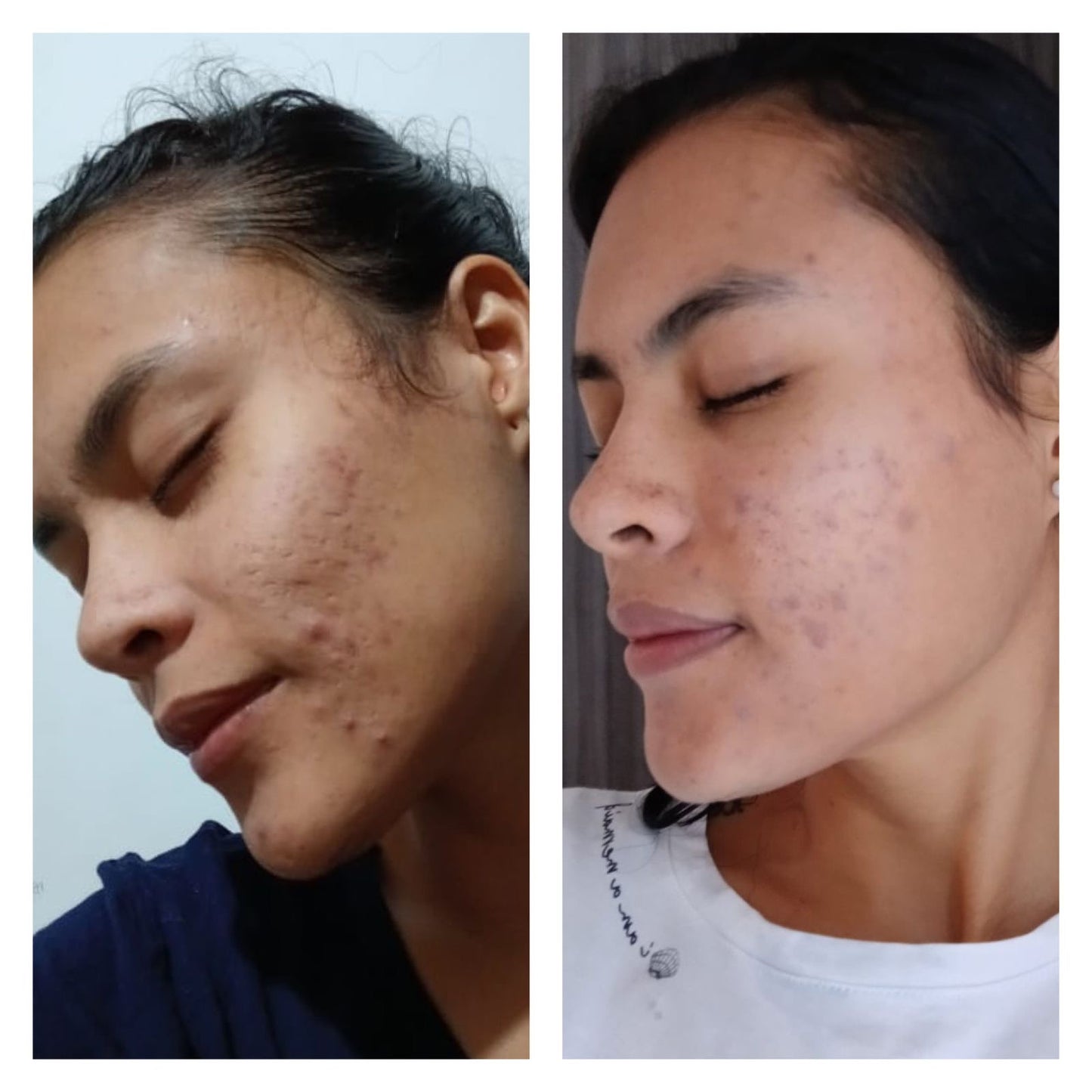 EL ORO PARA TU PIEL🎖️