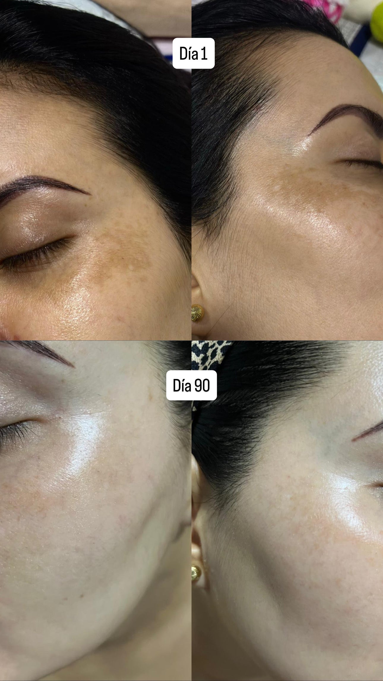 EL ORO PARA TU PIEL🎖️