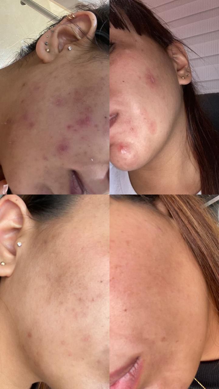 EL ORO PARA TU PIEL🎖️